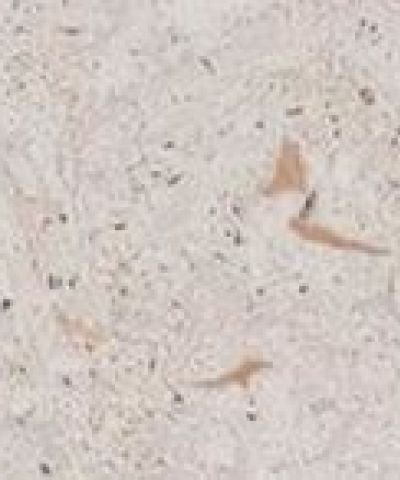 Nebbia – Dekton