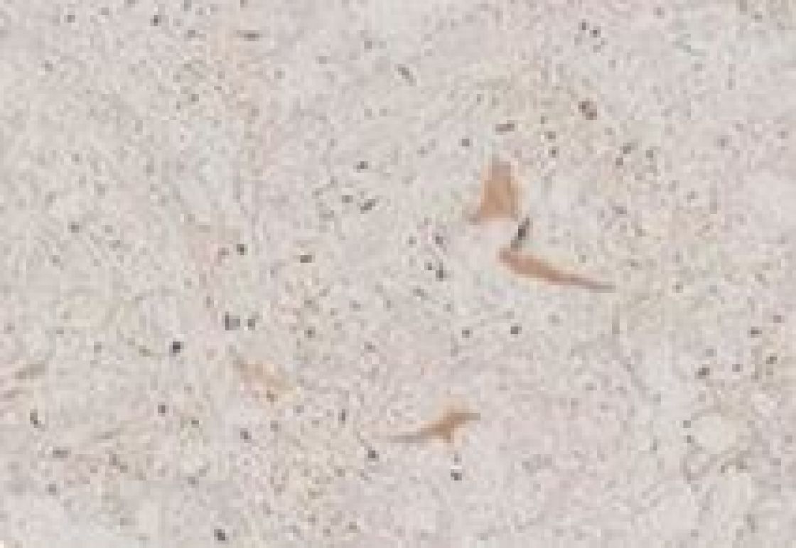Nebbia – Dekton – texture et veinage de la pierre